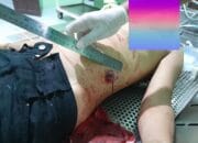 Niat Melerai Perkelahian, Gito Malah Tewas Dengan Usus Terburai