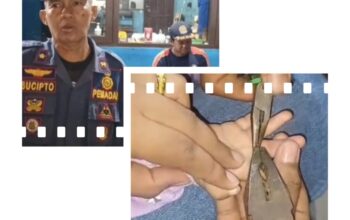 Tangis Orang Tua Berubah Lega, Tim Rescue Disdamkarmat Palangka Raya Lepaskan Cincin dari Jari Balita