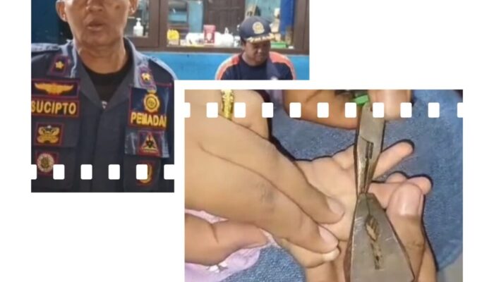Tangis Orang Tua Berubah Lega, Tim Rescue Disdamkarmat Palangka Raya Lepaskan Cincin dari Jari Balita
