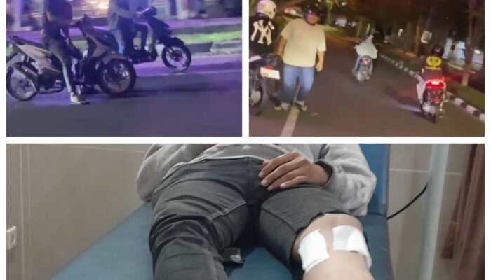 Diduga Tabrak Warga Saat Balap Liar di Palangka Raya, Korban Alami Luka di Kaki