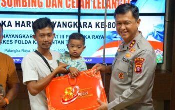 Operasi Bibir Sumbing Gratis Warnai Hari Bhayangkara ke-80, Polda Kalteng Bantu Wujudkan Senyum Baru Pasien