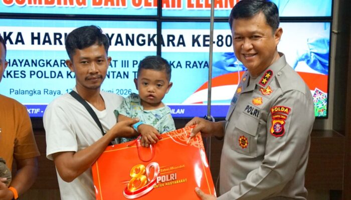 Operasi Bibir Sumbing Gratis Warnai Hari Bhayangkara ke-80, Polda Kalteng Bantu Wujudkan Senyum Baru Pasien