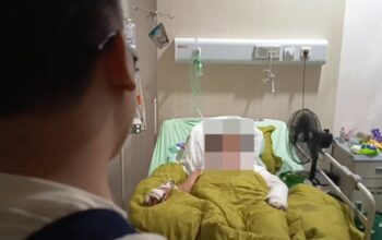 Pria di Sampit Siram dan Bakar Kekasihnya, Korban Alami Luka Bakar Serius