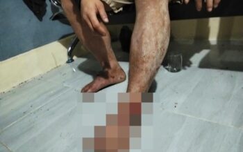 Dugaan Klinik Perusahaan di Kapuas Tak Layani Warga Kecelakaan, Ini Keluhannya