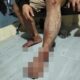 Dugaan Klinik Perusahaan di Kapuas Tak Layani Warga Kecelakaan, Ini Keluhannya